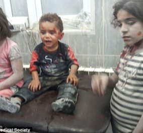 Συγκινητικό βίντεο: Ένα μικρό τραυματισμένο παιδί στη Συρία κλαίει και αρνείται να αποχωρήσει από την αγκαλιά του νοσηλευτή του