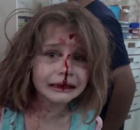 Θα στοιχειώνει τον 21ο αιώνα: «Πού είναι ο μπαμπάς μου;» βίντεο - Το κλάμα 8χρονης από τη Συρία μετά τους βομβαρδισμούς