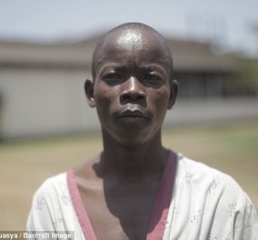 Η κατάρα ενός άνδρα: Το πέος του έφτανε το 1 μέτρο και έκανε επέμβαση για να το μικρύνει 
