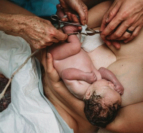 Birth Photography Image Competition: Τα κλικς που μας ανατρίχιασαν - Το θαύμα της ζωής & οι νικητές   