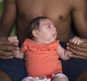 Συναγερμός για ιό Ζίκα σε όλη την Αμερική - Με νοητική υστέρηση γεννιούνται τα μωρά σε Βραζιλία