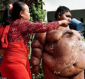 Story of the day:10 ετών & ζυγίζει 192 κιλά - Ο μικρός Ινδονήσιος περπατάει & πέφτει , δεν μπορεί να ντυθεί