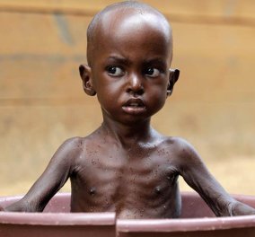 Δραματικές ώρες για την Σομαλία: 110 νεκροί σε 2 μέρες από την πείνα - 1,4 εκ παιδιά αντιμέτωπα με τον θάνατο