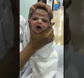 Βίντεο που κάνει τον γύρο του κόσμου δείχνει νοσοκόμες να "παίζουν" παραμορφώνοντας το κεφάλι ενός βρέφους 