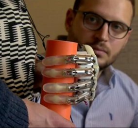 Κατασκευάστηκε το πρώτο βιονικό χέρι που προσφέρει αίσθηση αφής- Μπορεί να χρησιμοποιηθεί & εκτός εργαστηρίου 
