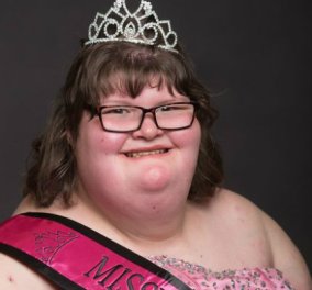 15χρονη ζυγίζει 170 κιλά μα στέφθηκε βασίλισσα της ομορφιάς! Η κοπελίτσα πάσχει από το σύνδρομο Prader - Willi (ΦΩΤΟ)