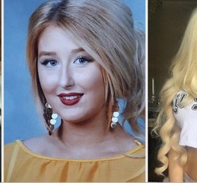 22χρονη ονειρευόταν να μοιάσει στην Barbie, ξόδεψε 40.000 λίρες σε πλαστικές - Έγινε αξιοθρήνητη (Φωτό)