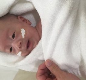 Συγκίνηση: Βγήκε από το νοσοκομείο υγιές  το μικρότερο μωράκι του κόσμου- Όταν γεννήθηκε ζύγιζε 268 γρ. (φώτο)