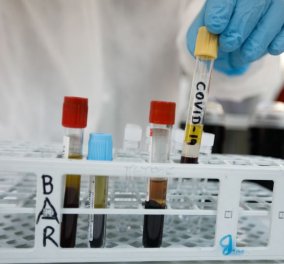 Λέγεται  Coronavac και είναι το πρώτο εμβόλιο Κινέζου ερευνητή – Έτοιμη για παραγωγή 100 εκατ. δόσεων