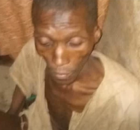 Νιγηρία: 30χρονος βρέθηκε ετοιμοθάνατος σε γκαράζ - Οι γονείς του τον έβαλαν εκεί για 7 χρόνια 