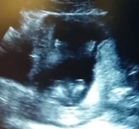 To βίντεο της ημέρας: Έμβρυο χτυπά παλαμάκια όταν τραγουδούν οι γονείς του!