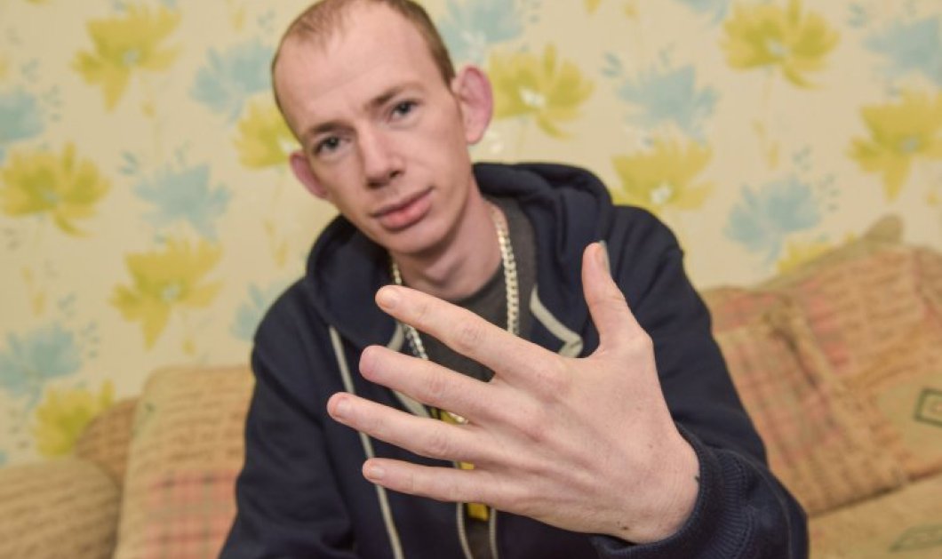 Φώτο: 26χρονος έγινε τύφλα στο μεθύσι: Ξύπνησε και είχε μισό δάχτυλο και αμνησία  - Κυρίως Φωτογραφία - Gallery - Video