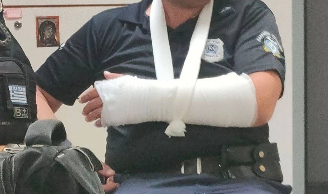Άγριο περιστατικό στην Λάρισα τα ξημερώματα: Σοκαριστικές οι φωτό με τους τραυματισμένους αστυνομικούς από επίθεση 30 ατόμων - Κυρίως Φωτογραφία - Gallery - Video